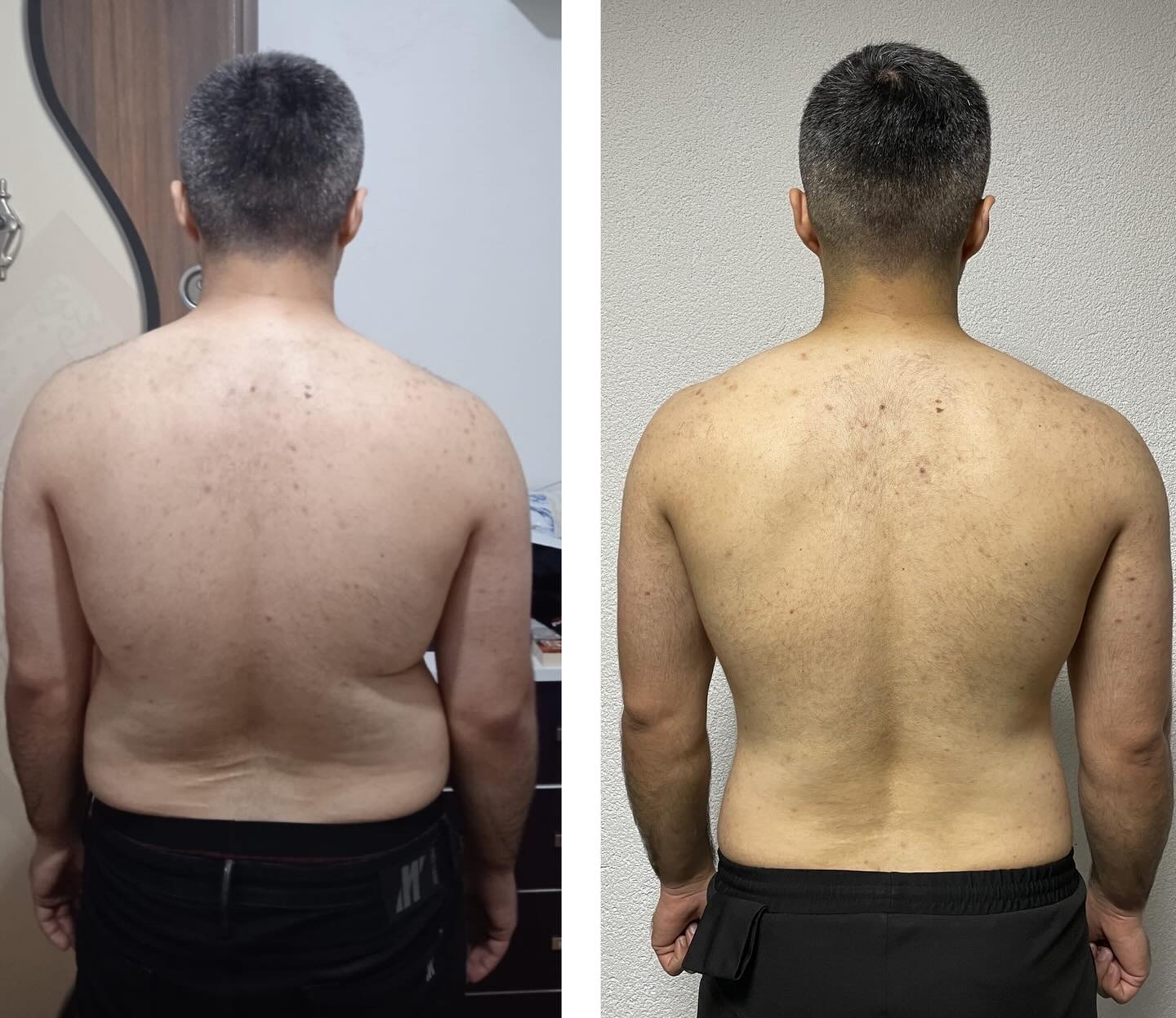 Before After Transformation 7